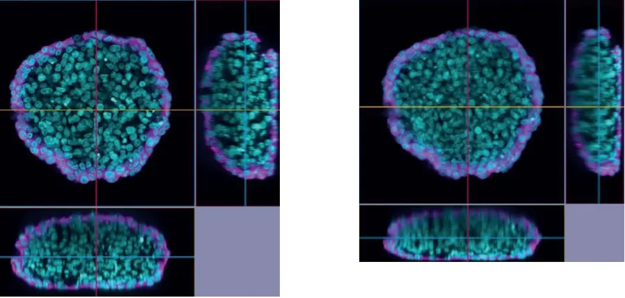 Figure 11. XYZ image comparison. Left: LUPLAPO25XS silicone gel pad objective, NA 0.85. Right: UPLXAPO20X dry objective, NA 0.8. Cleared HeLa* 1 cell spheroid (cyan: nuclei, magenta: microtubules). Captured on the IXplore IX85 Spin spinning disk confocal microscope. *To learn more about the origin of HeLa cells, visit henriettalacksfoundation.org.