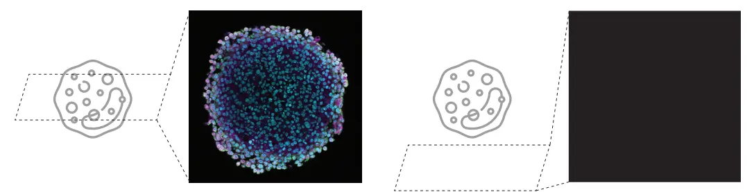Figure 4. The high difficulty of sample searching in confocal laser scanning microscopy can lead to a blank screen (right image)