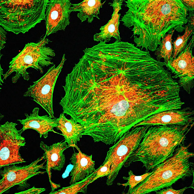 Laser power that is too high leads to high phototoxicity