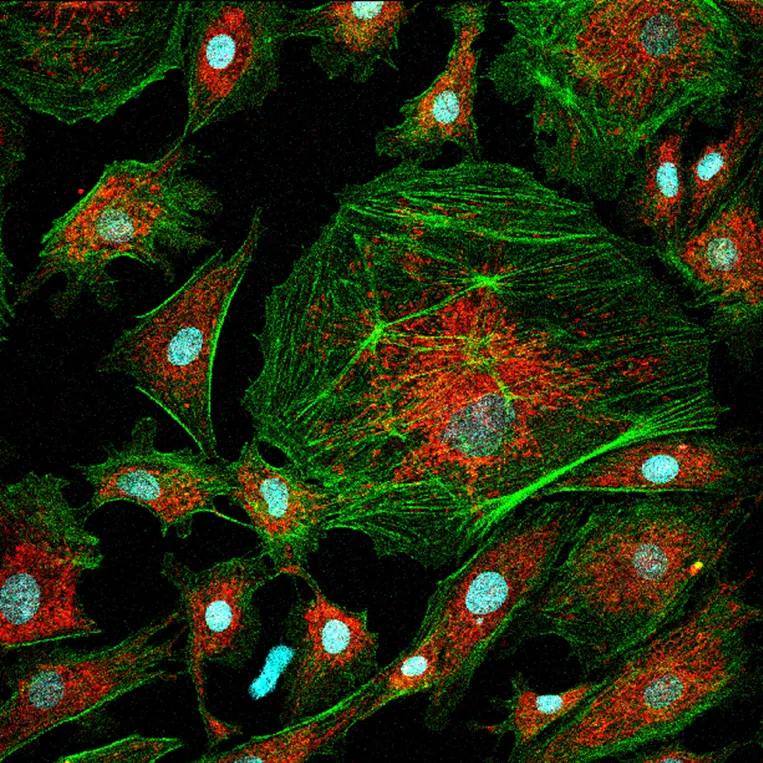 Laser power that is too high leads to noisy images