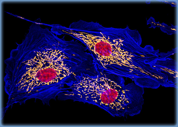 Filamentous Actin and Mitochondrial Networks in a Culture of Bovine Pulmonary Artery Cells