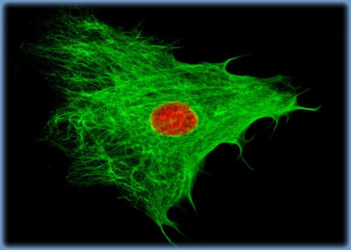 Intermediate Filaments in FoLu Fox Lung Fibroblasts