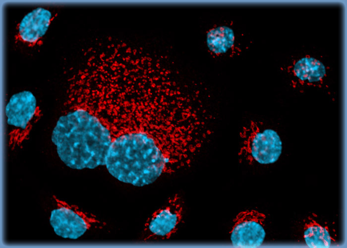 Visualizing the Proximity Between the Golgi Complex and the Nucleus in Carcinoma Cell Cultures