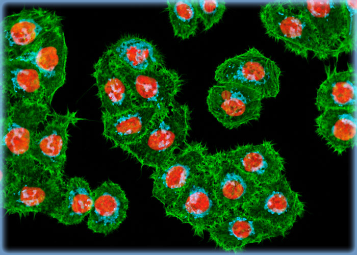 Targeting Giantin in Cancer Cells with Immunofluorescence