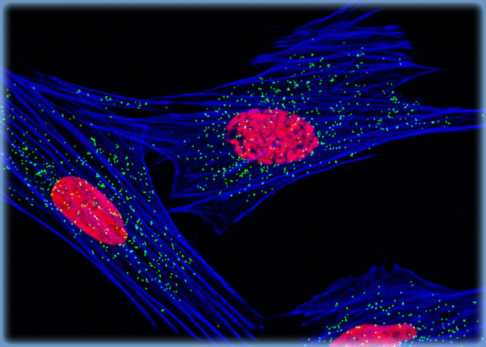 Peroxisome and Histone Protein Distribution in Muntjac Fibroblasts