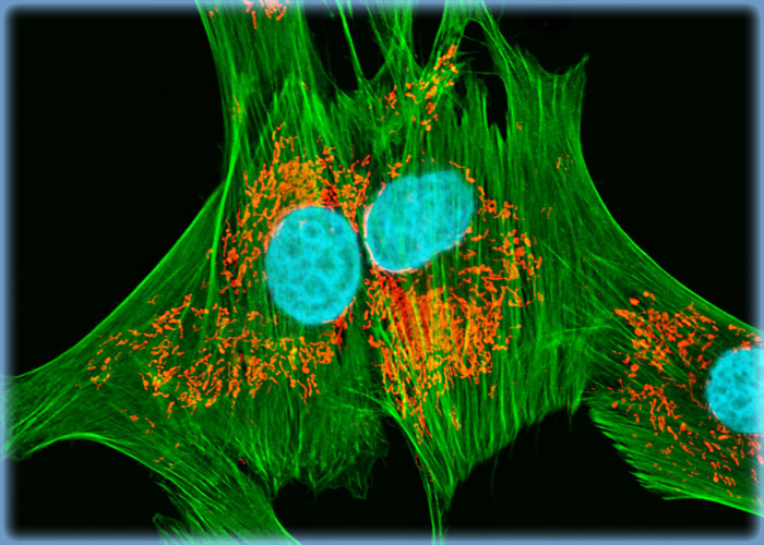 Targeting F-Actin and Mitochondria in Pl 1 UT Cell Cultures