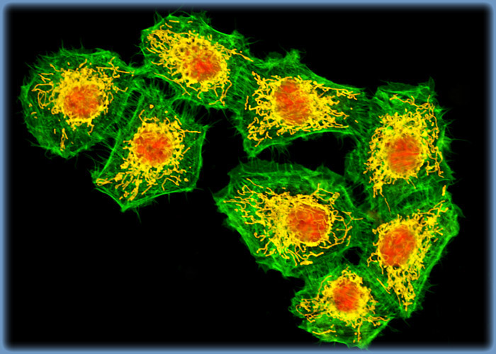 Human Brain Glioma Cells (U-118 MG Line)