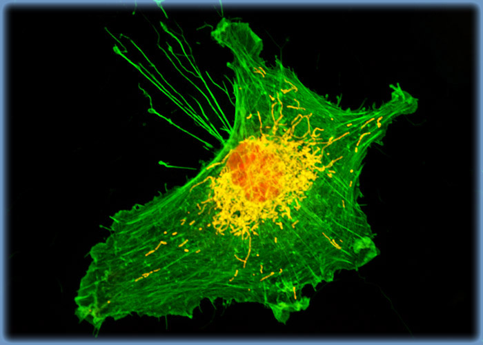 Targeting F-Actin and the Mitochondrial Network in Human Brain Glioma Cell Cultures