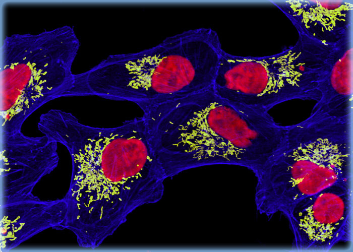 Normal African Green Monkey Kidney Epithelial Cells (Vero Line)