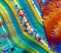 Hoffman Modulation Contrast Microscopy