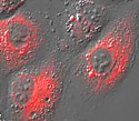 Rabbit Kidney Epithelial Cells with tdTomato ER