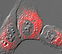 Human Osteosarcoma Epithelial Cells with DsRed ER