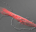 Human Glioblastoma Epithelial Cells with mCherry Actinin