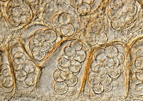 Cucumber Tapeworm (Dipylidium caninum)