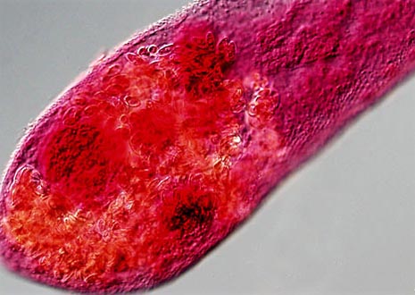 Intestinal Fluke (Heterophyes)