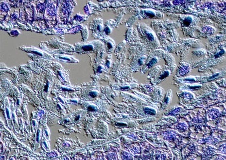 Nucleic Acid Stains