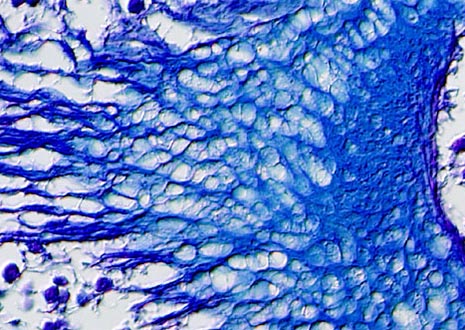 Portuguese Man-of-War Tentacles