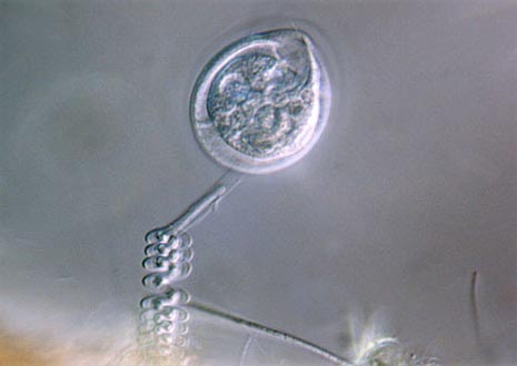 Vorticella Ciliates