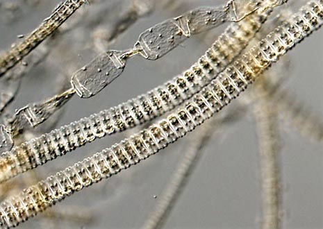 Zygnema Filamentous Algae