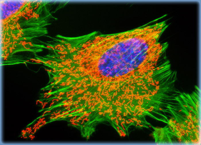 Embryonic Swiss Mouse Fibroblast Cells (3T3)