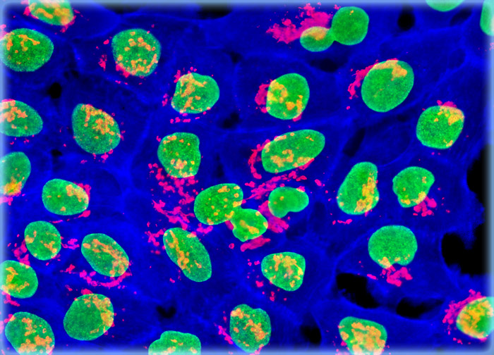 Human Skin Epidermoid Carcinoma Epithelial Cells (A-431)