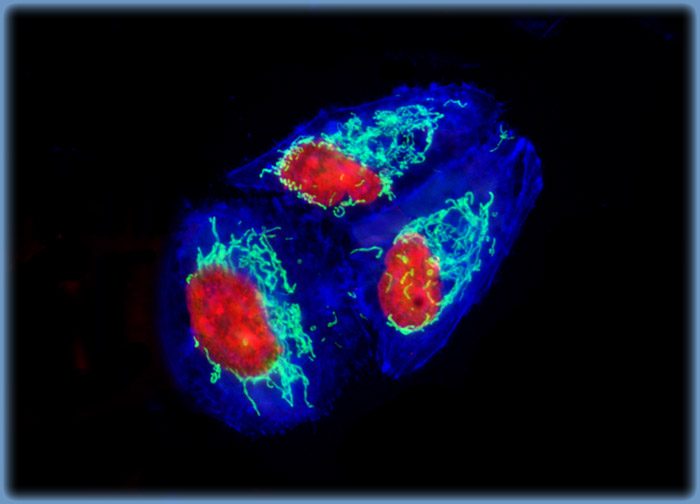 Human Lung Carcinoma Cells (A-549 Line)