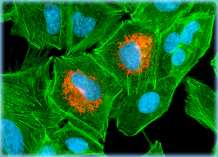 Human Lung Carcinoma Cells (A-549 Line)