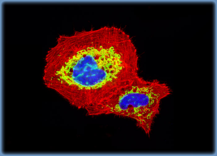 Human Lung Carcinoma Cells (A-549 Line)