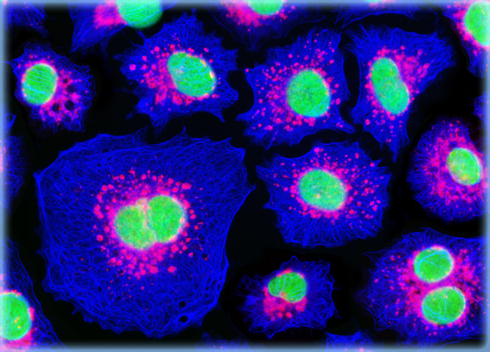 Human Lung Carcinoma Cells (A-549 Line)