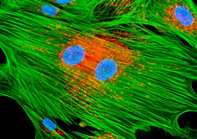 Mongoose Skin Fibroblast Cells (APM)