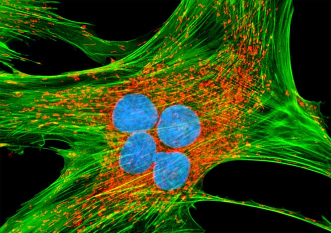 Mongoose Skin Fibroblast Cells (APM)