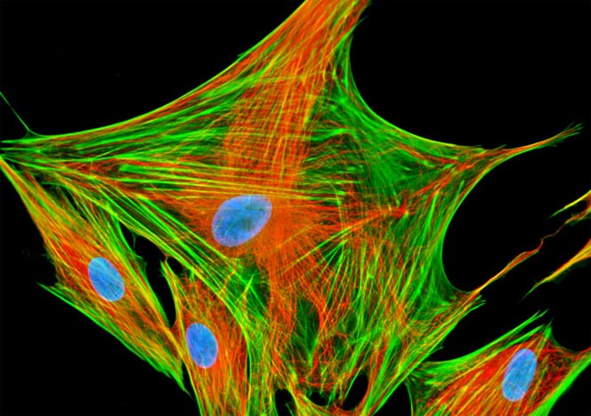 Mongoose Skin Fibroblast Cells (APM)