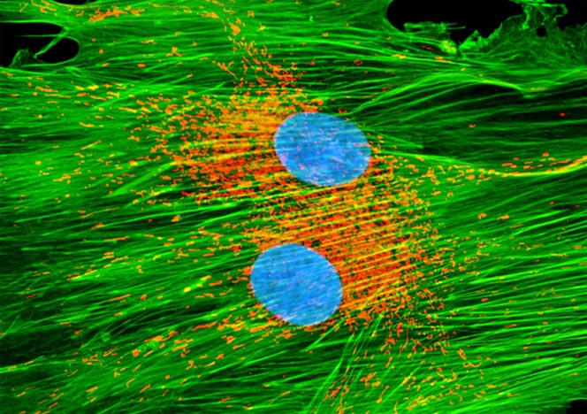 Mongoose Skin Fibroblast Cells (APM)