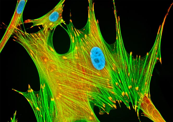 Mongoose Skin Fibroblast Cells (APM)