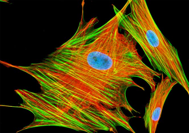 Mongoose Skin Fibroblast Cells (APM)