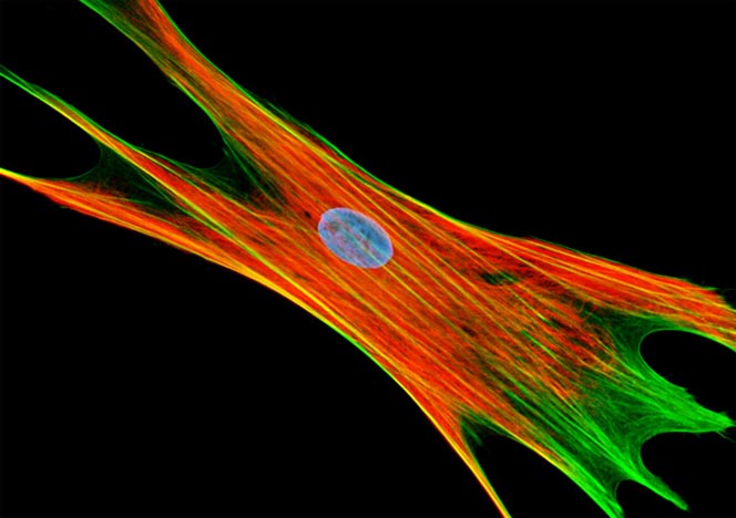 Mongoose Skin Fibroblast Cells (APM)