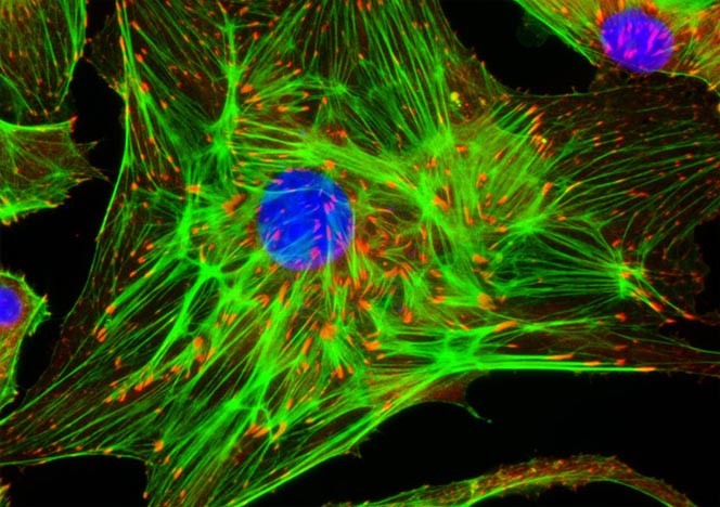 Bovine Pulmonary Artery Endothelial Cells (BPAE Line)