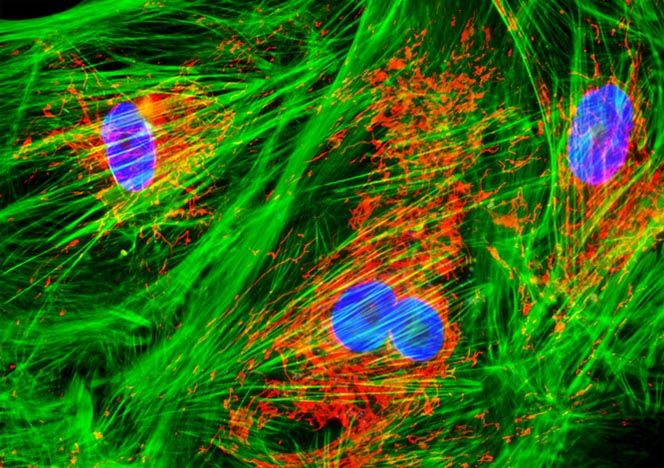 Human Cortical Neuronal Cells (HCN-1A Line)