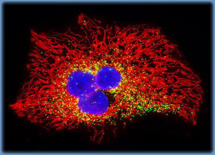 Human Cervical Adenocarcinoma Cells (HeLa Line)