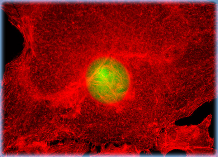 Human Cervical Adenocarcinoma Cells (HeLa Line)