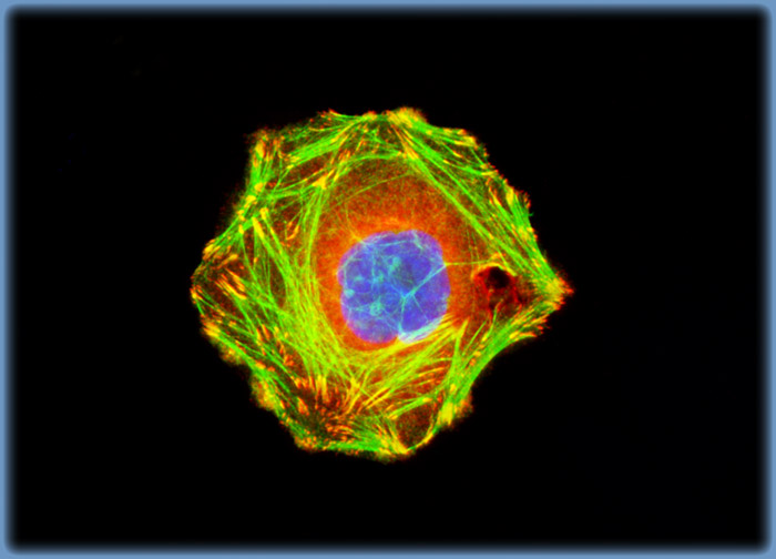 Human Cervical Adenocarcinoma Cells (HeLa Line)