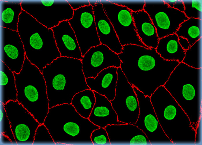 Pig Kidney Epithelial cells (LLC-PK1)