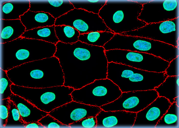 Pig Kidney Epithelial cells (LLC-PK1)