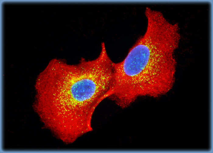 Madin-Darby Canine Kidney Epithelial Cells (MDCK Line)