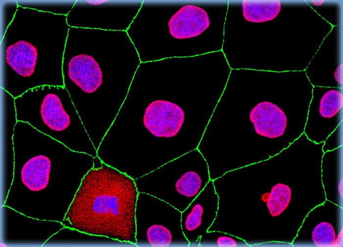 Madin-Darby Canine Kidney Epithelial Cells (MDCK Line)