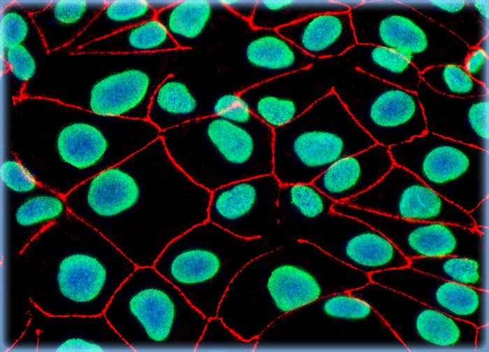 Madin-Darby Canine Kidney Epithelial Cells (MDCK Line)