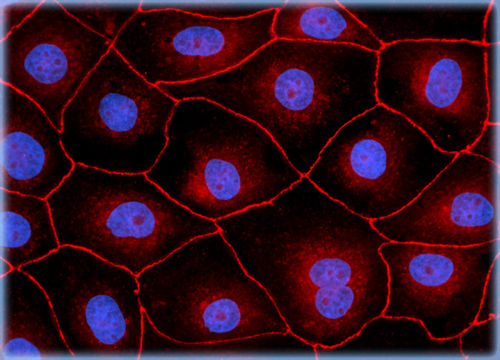 Madin-Darby Canine Kidney Epithelial Cells (MDCK Line)