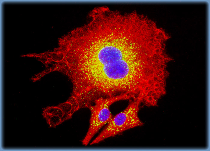 Normal Rat Kidney Epithelial Cells (NRK)