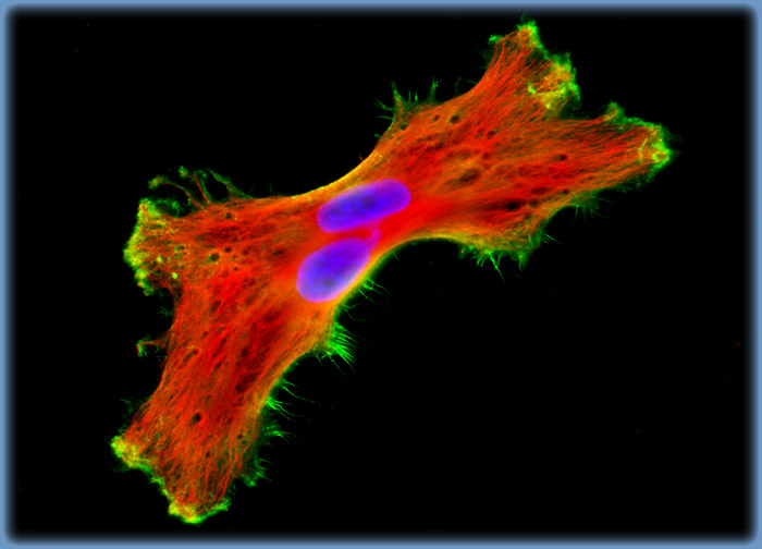 Human Brain Glioma Cells (U-118 MG Line)