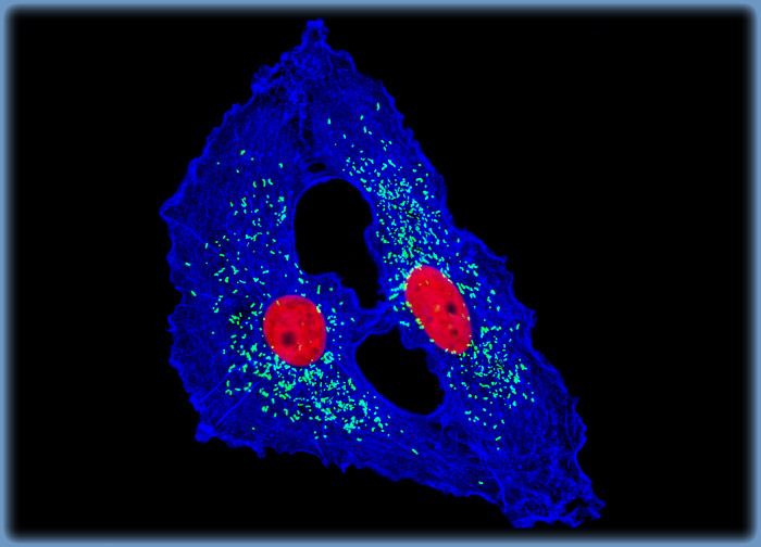 Human Brain Glioma Cells (U-118 MG Line)